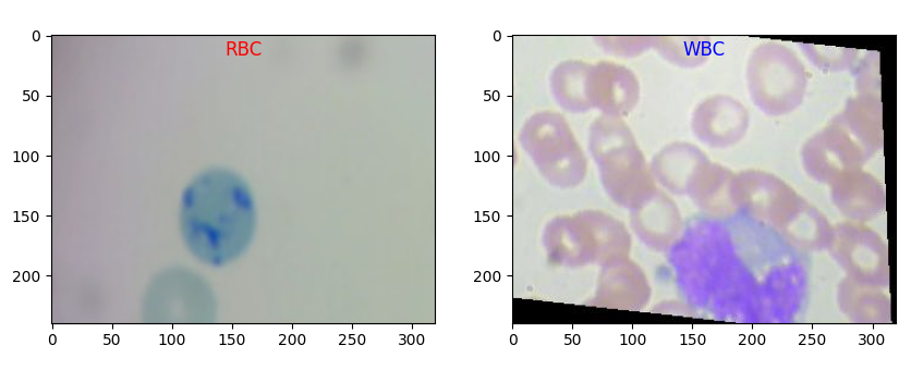 blood-cell-segmentation